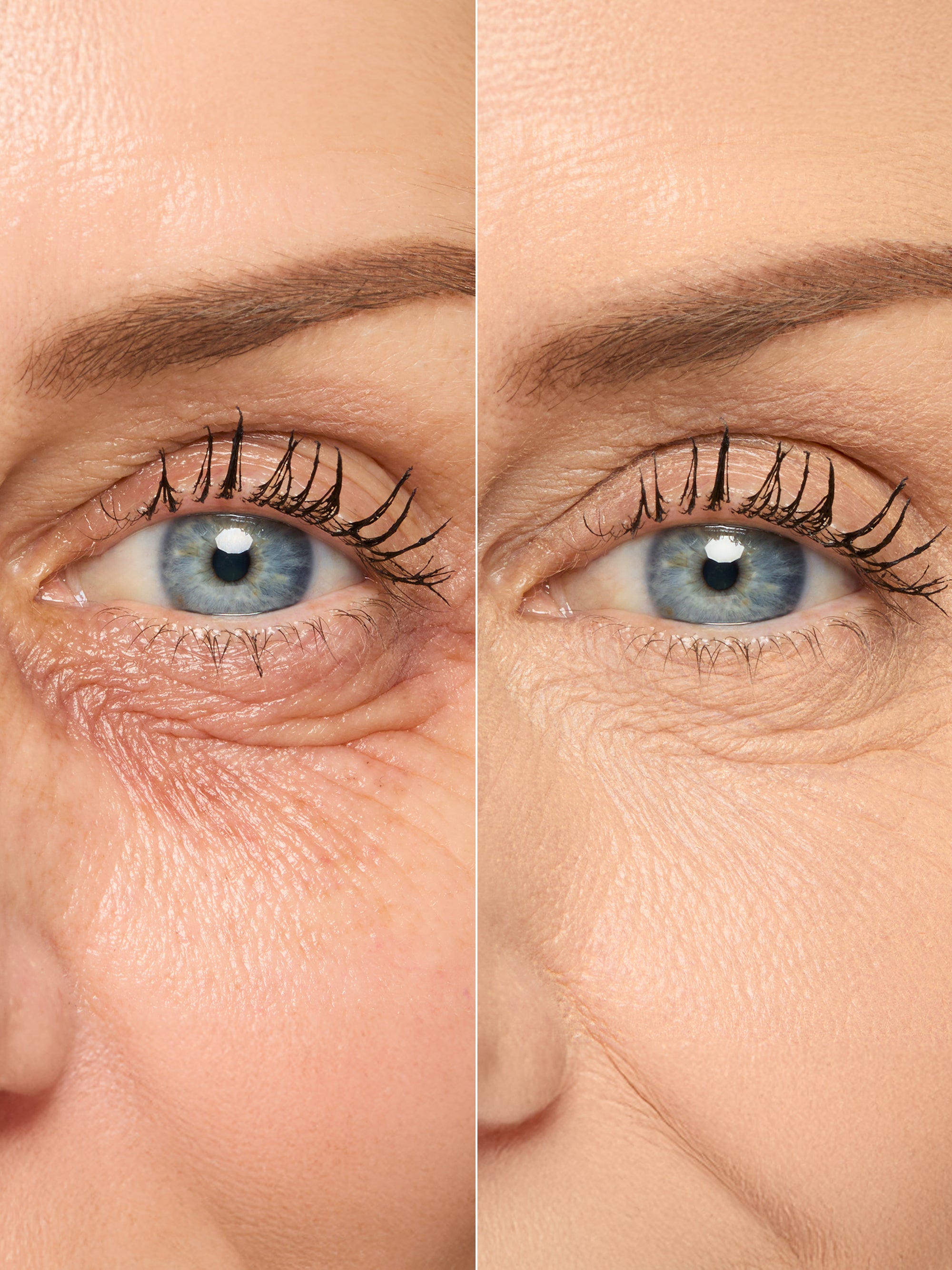 best undereye concealer for dry & mature skin