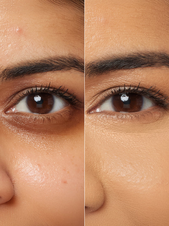 best concealers for dark circles