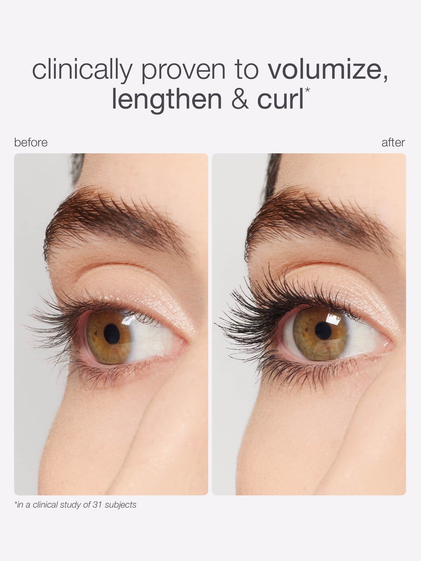 Before and after comparison of eyelashes with text indicating clinical provenance.