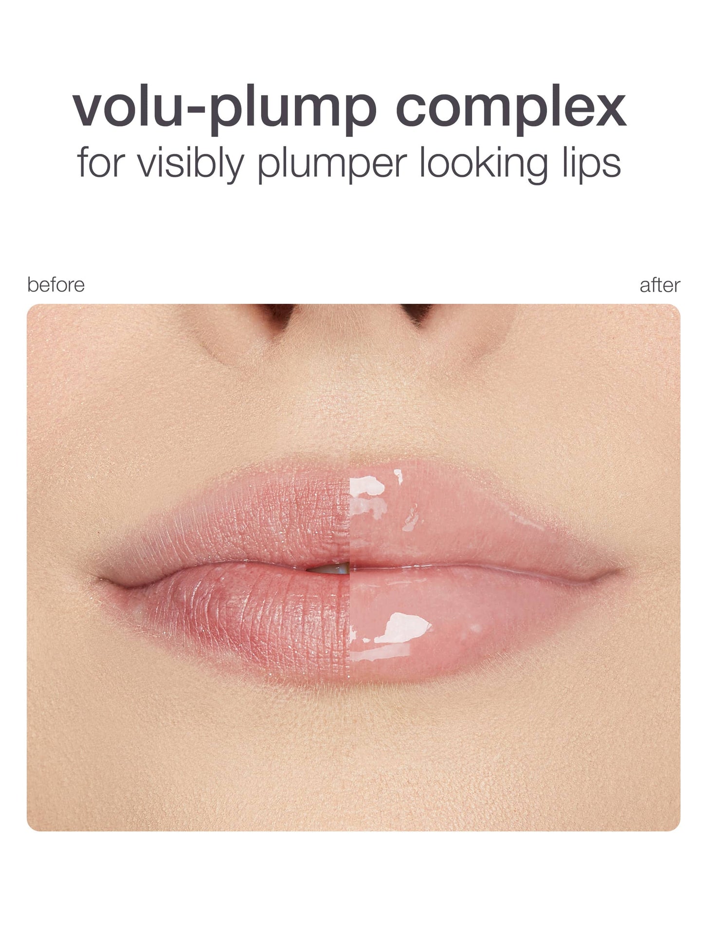 Before and after comparison of lips using a volu-plump complex product.