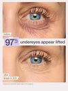 Before and after comparison of under-eye bags using tarte cc undereye in shade 35H