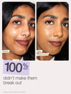 Before-and-after with the 'before' showing a more textured, acne-prone complexion and 'after' showing smoother, clearer skin.'100% agree didn't make them break out' using tarte shape tape stick