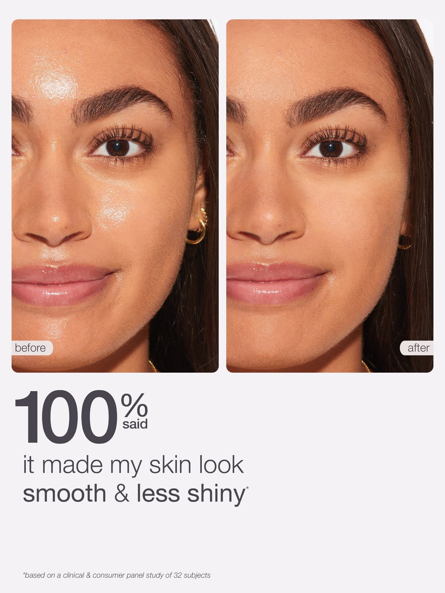 Before and after comparison of a woman's face with text indicating improved skin texture.