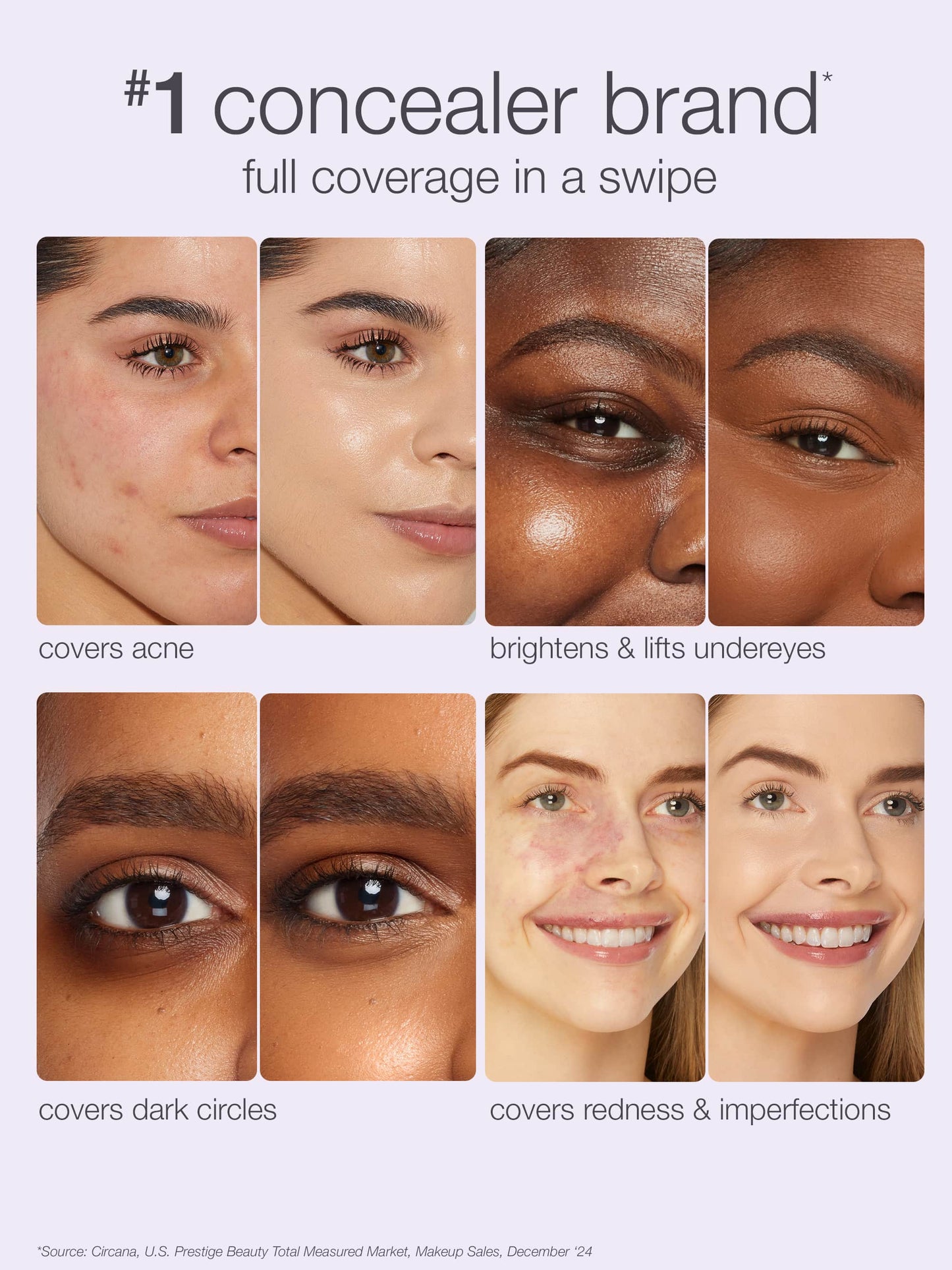 The image shows a split panel comparison of faces before and after makeup application. Text reads 1 concealer brand* full coverage in a swipe. Covers acne, brightens & lifts undereyes, covers dark circles, covers redness & imperfections. The source at the bottom mentions, Circana, U.S. Prestige Beauty Total Measured Market, Makeup Sales, December ‘24.