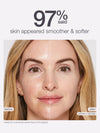 Before and after comparison of a woman's face with text indicating smoother and softer skin.