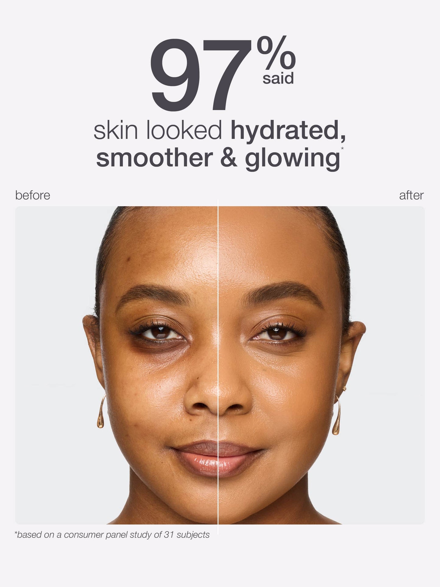 Before and after comparison of a woman's face with text indicating skin improvement.
