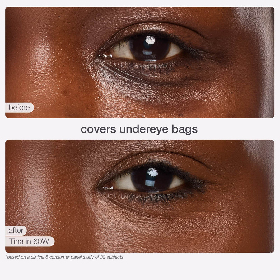 Before and after under eye bags coverage