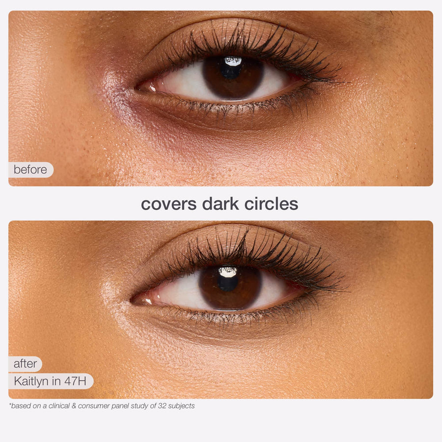 Before and after dark circles coverage