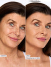 Before and after comparison of a woman's face with visible skin texture differences, labeled 'before' and 'after' with 'Stephanie in 35N'.