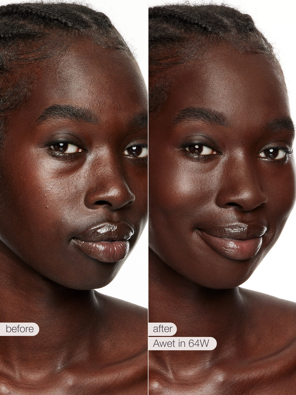Before and after comparison of a woman's face with text indicating a treatment or product name.