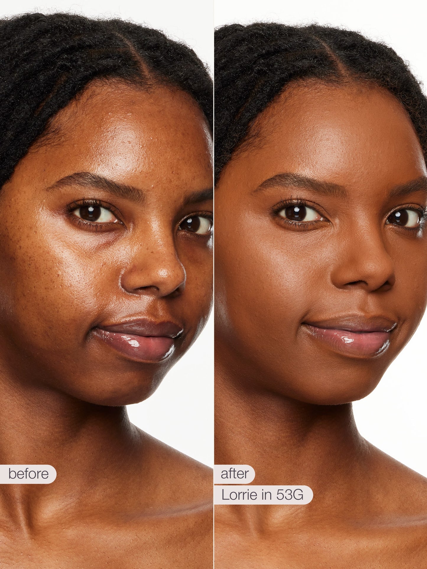 Before and after comparison of a woman's face with Lorie in 53G product application.