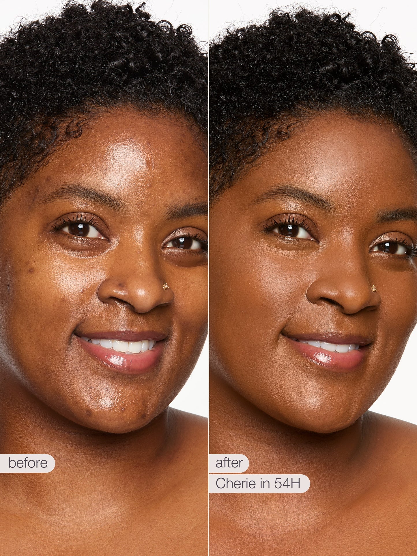 Before and after comparison of a woman's face with text indicating 'before' and 'after' with a product name.