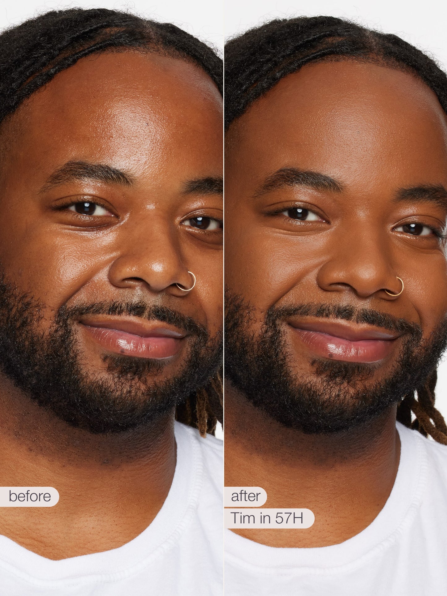 Before and after comparison of a man with dreads, showing a visible change in skin texture and color over time.