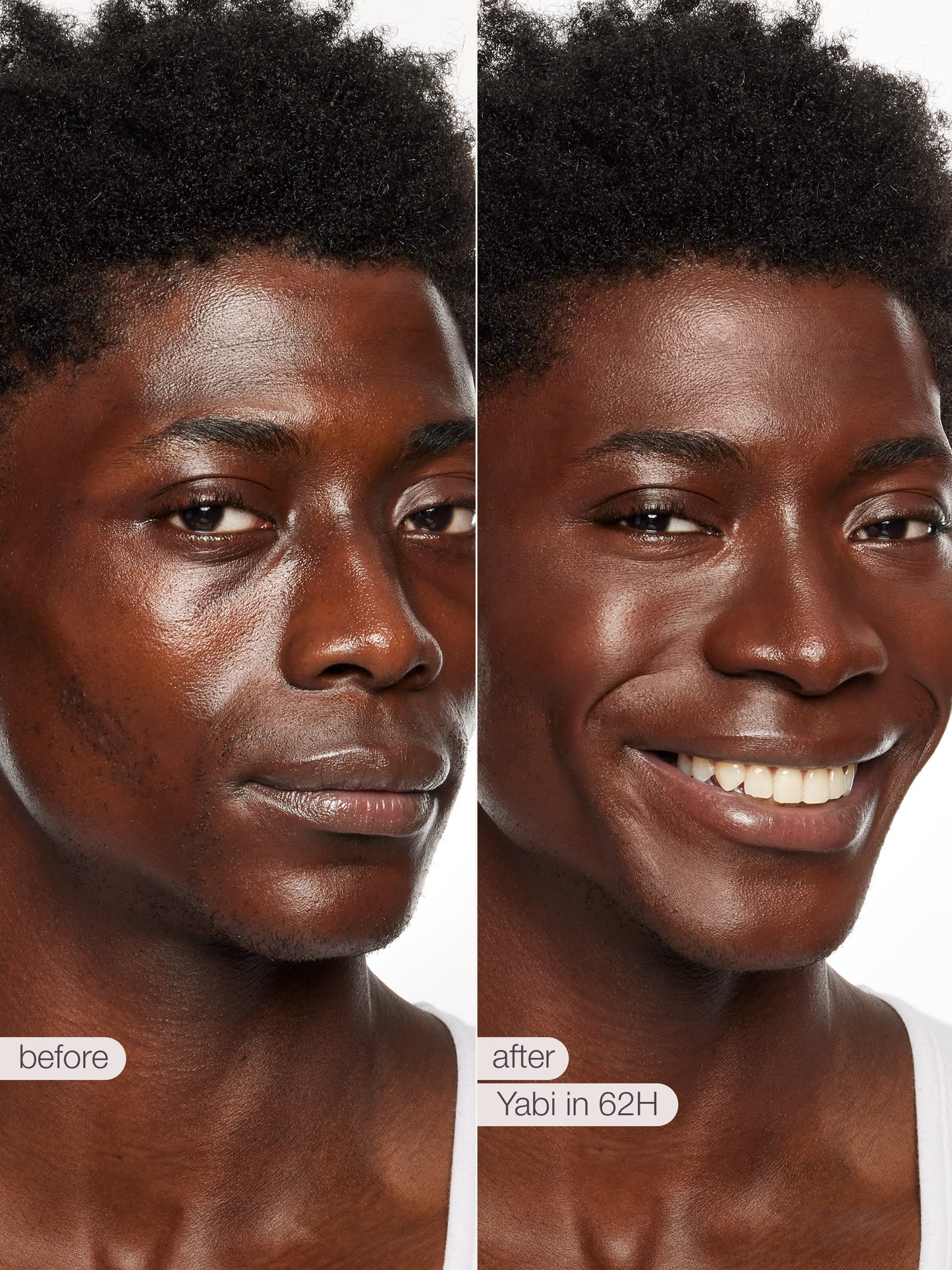 Before and after comparison of a person's face with text indicating 'before' and 'after' and product name.