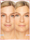 Before and after comparison of a woman's face with 'before' and 'pink' labels.