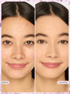 Before and after comparison of a woman's face with skin treatment effects, labeled 'before' and 'lavender'.