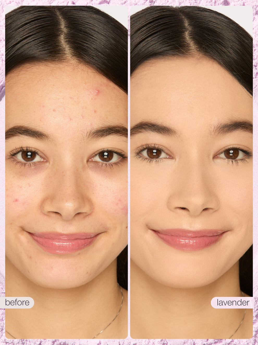 Before and after comparison of a woman's face with skin treatment effects, labeled 'before' and 'lavender'.