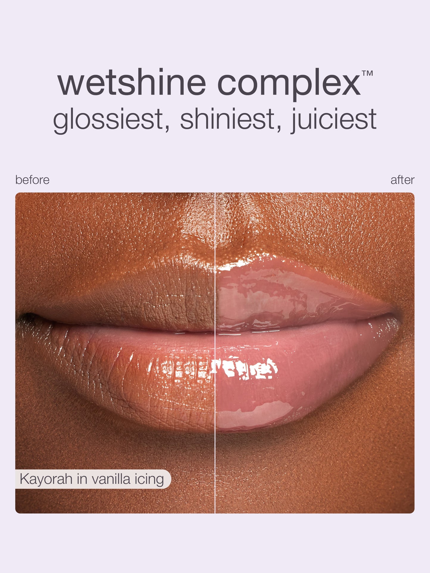 vanilla icing collection