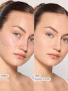 Before and after comparison of a woman's face with skin treatment labeled 'Nellie in 22N'.
