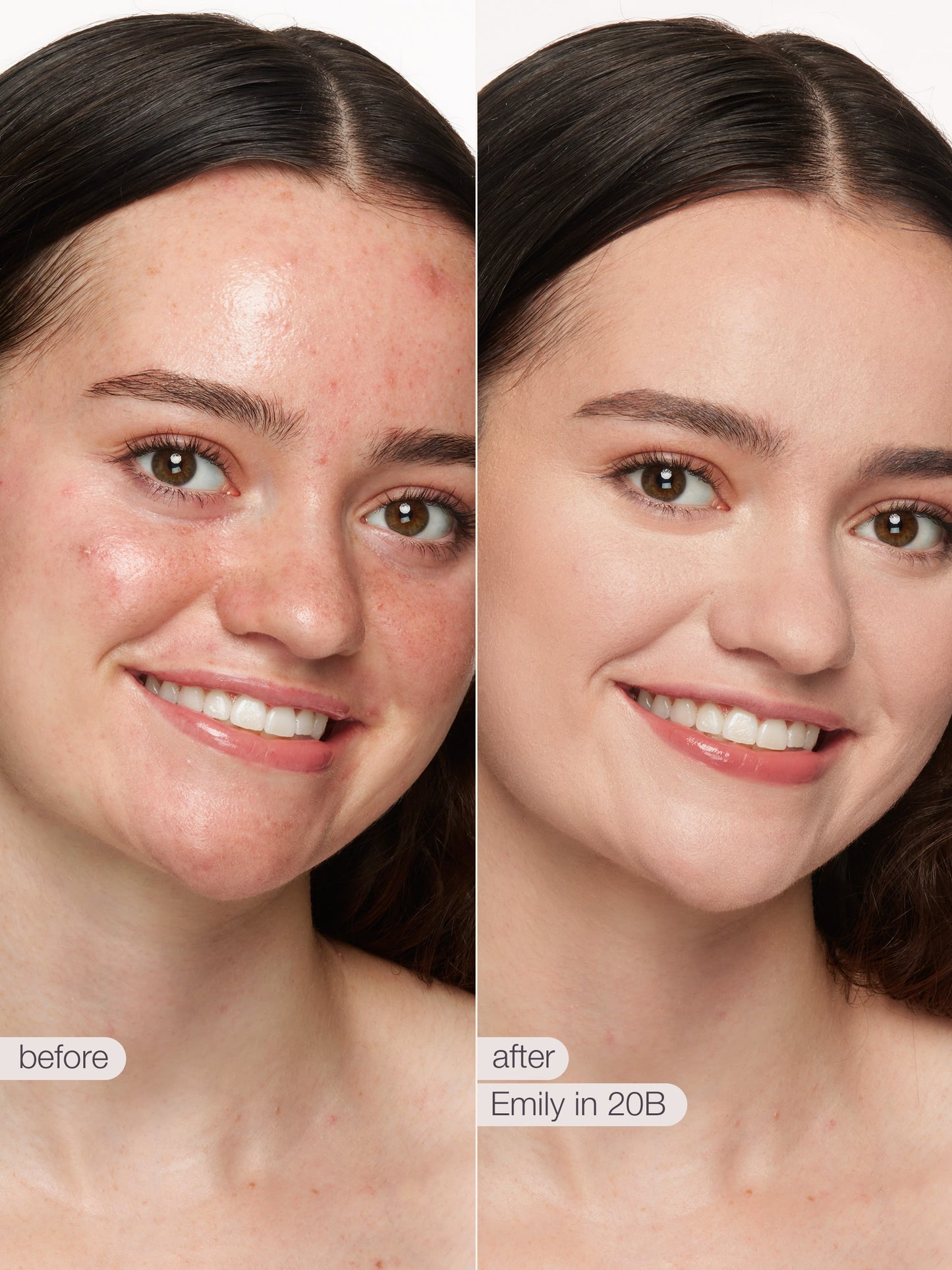 Before and after comparison of a woman's face with visible skin improvement.