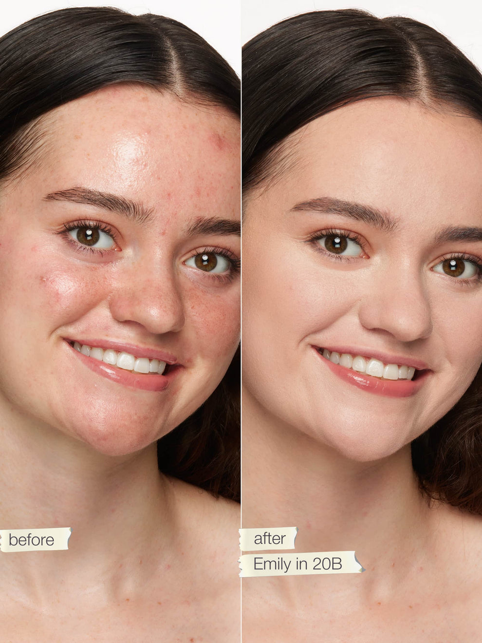 Before and after comparison of a woman's face with visible skin improvement.