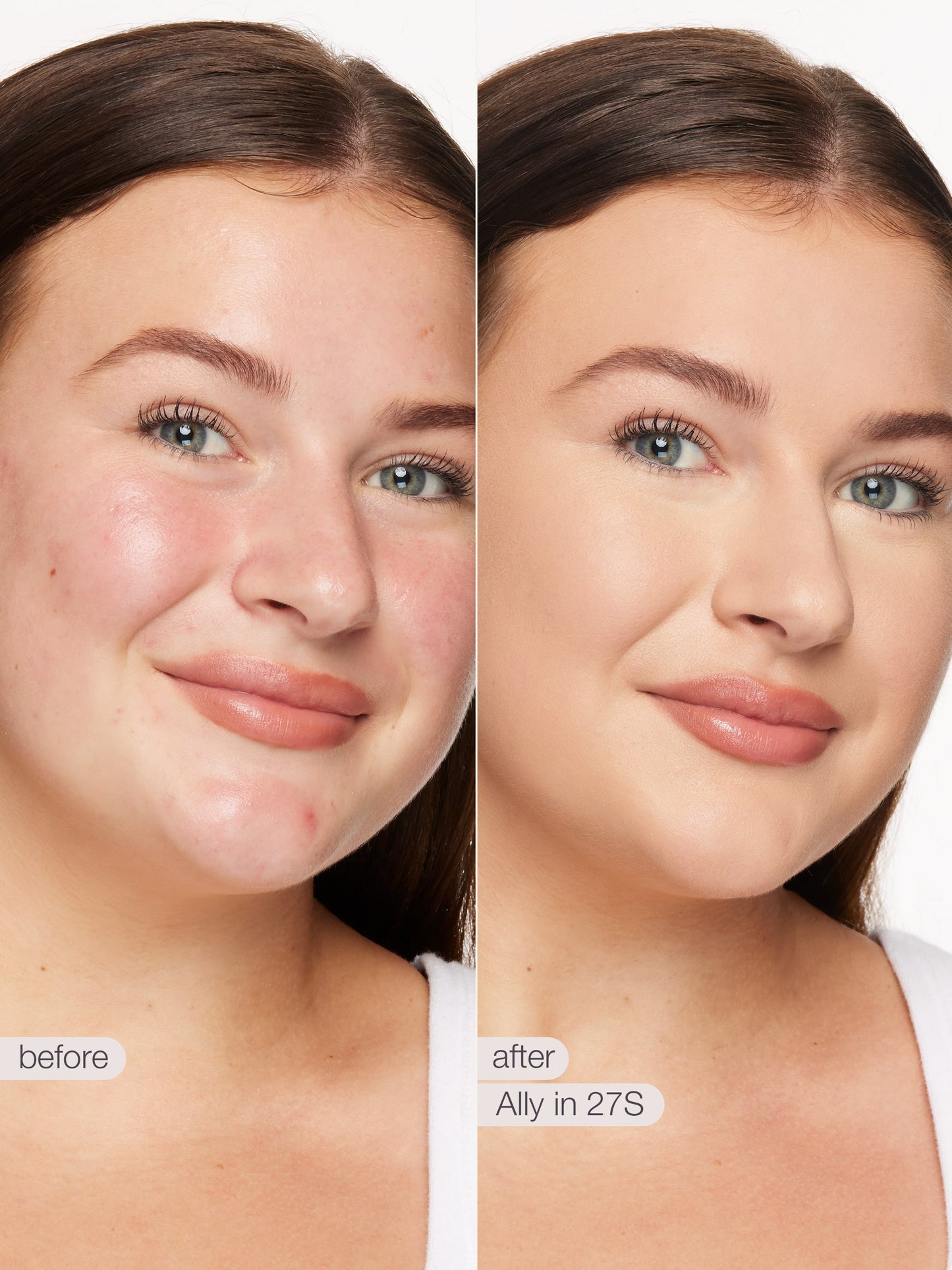 Before and after comparison of a woman's face with visible skin improvement using a product labeled 'Ally in 27S'.