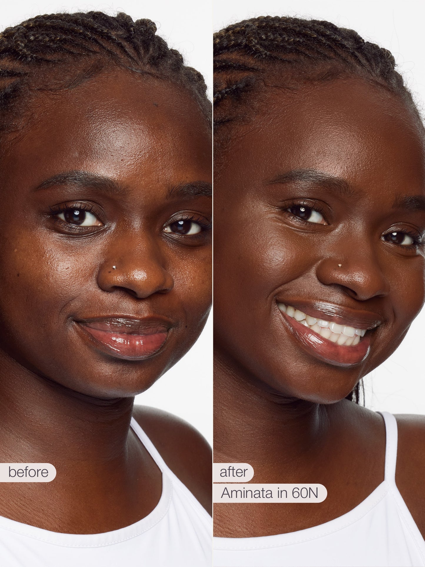 Before and after comparison of a woman's face with visible skin improvement using Aminata in 60N.