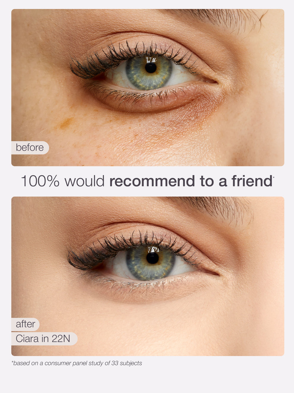 Before and after comparison of a eye treatment showing a visible improvement.
