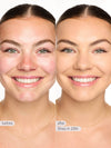 Before and after comparison of a woman's face with skincare product application.