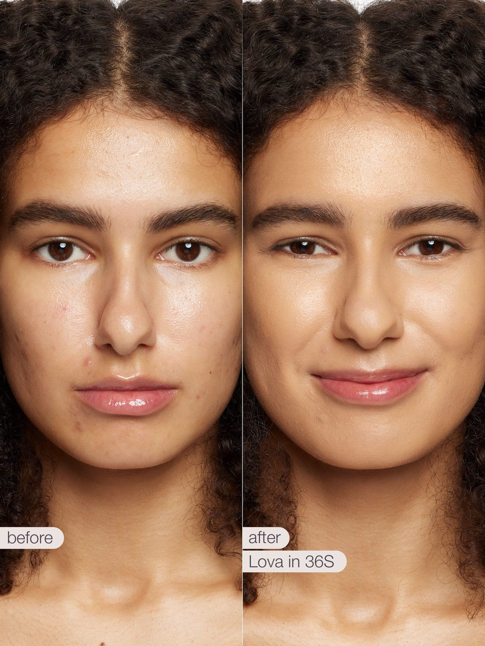 Before and after comparison of a woman's face with Lova skincare product.