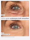 Before and after comparison of under-eye area with text indicating smoother appearance.