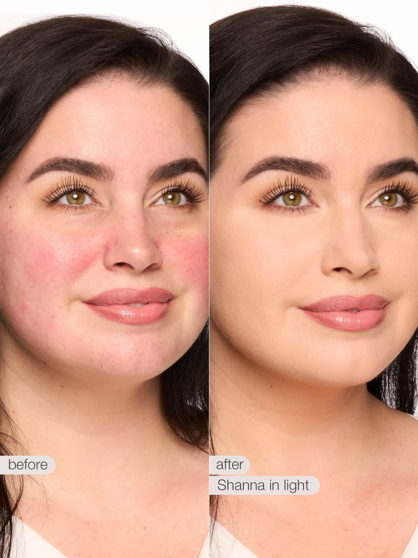 Before and after comparison of a woman's face with text indicating 'before' and 'after' with 'Shanna in light'.