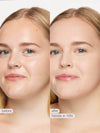 Before and after comparison of a woman's face with visible skin treatment results.