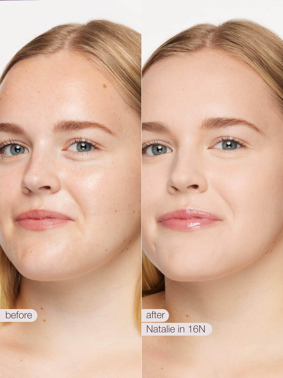 Before and after comparison of a woman's face with visible skin treatment results.
