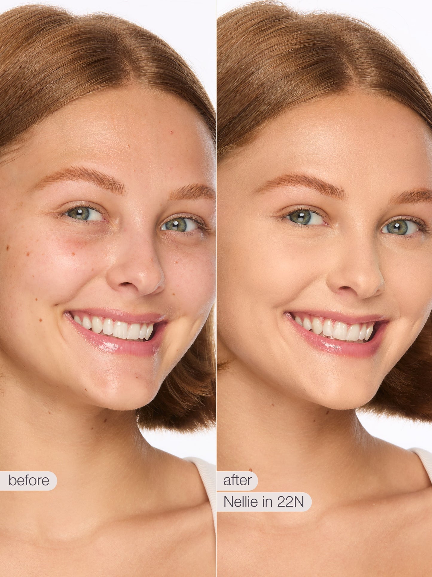 Before and after comparison of a woman's face with skin treatment labeled 'Nellie in 22N'.