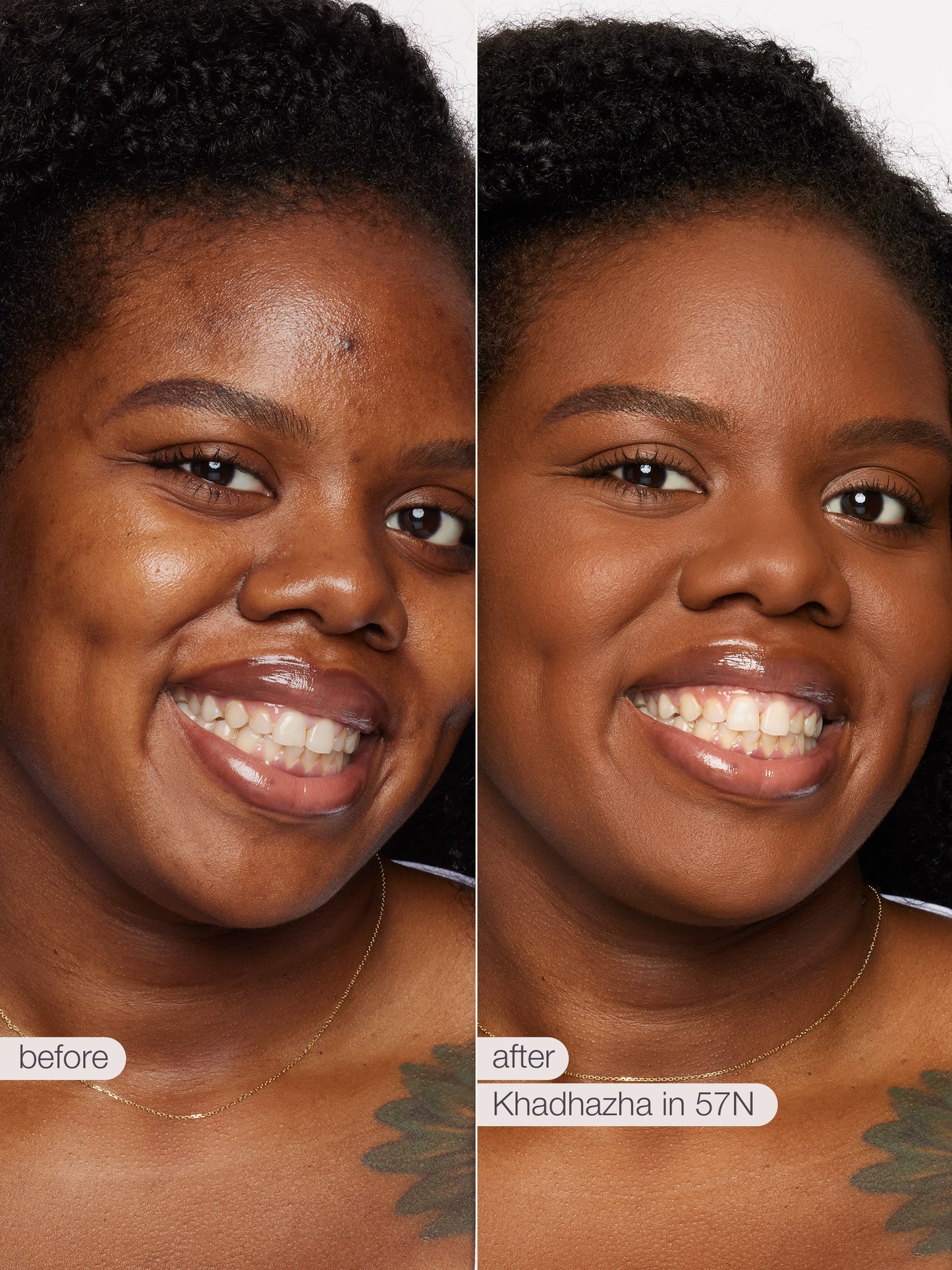 Before and after comparison of a woman's face with Knadadhza in 57N application.