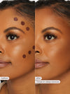 Before and after comparison of a woman's face with blemishes, using a cosmetic product labeled 'Tinieae in deep bronze'.