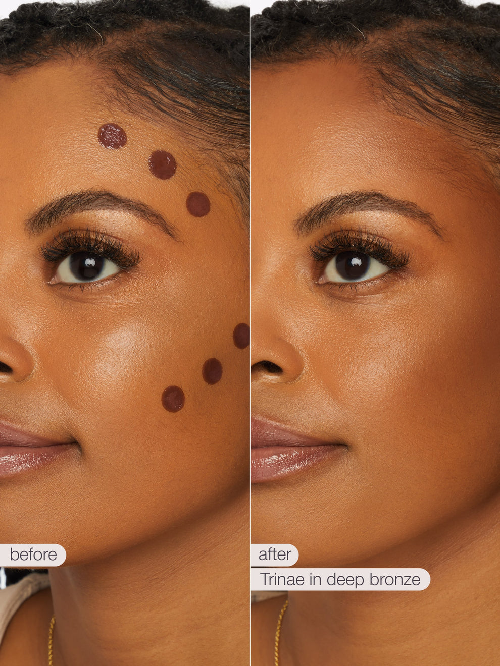 Before and after comparison of a woman's face with blemishes, using a cosmetic product labeled 'Tinieae in deep bronze'.