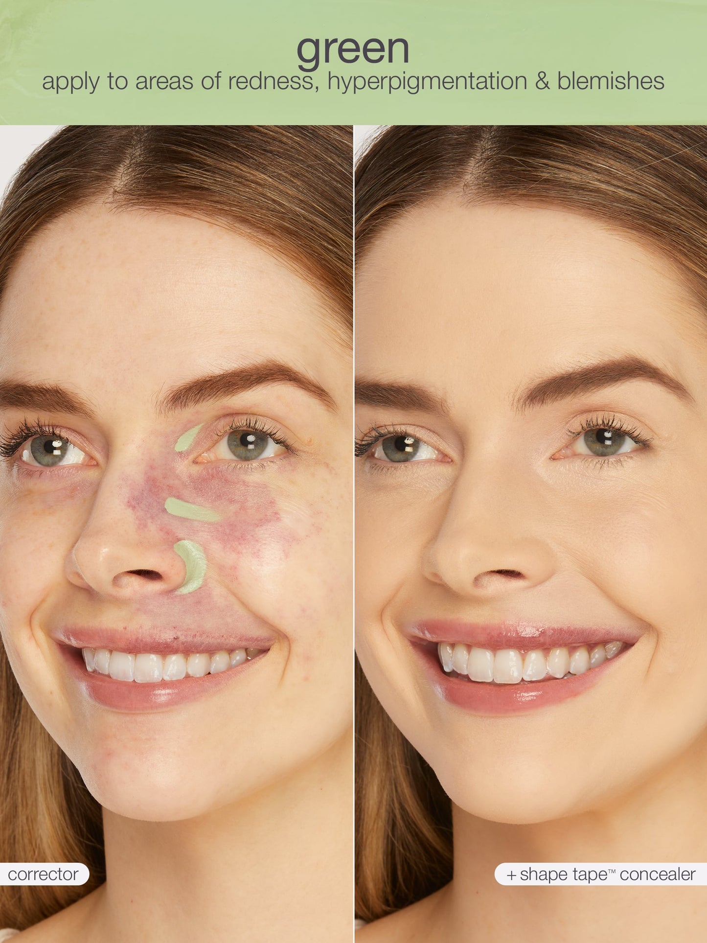 shape tape™ corrector