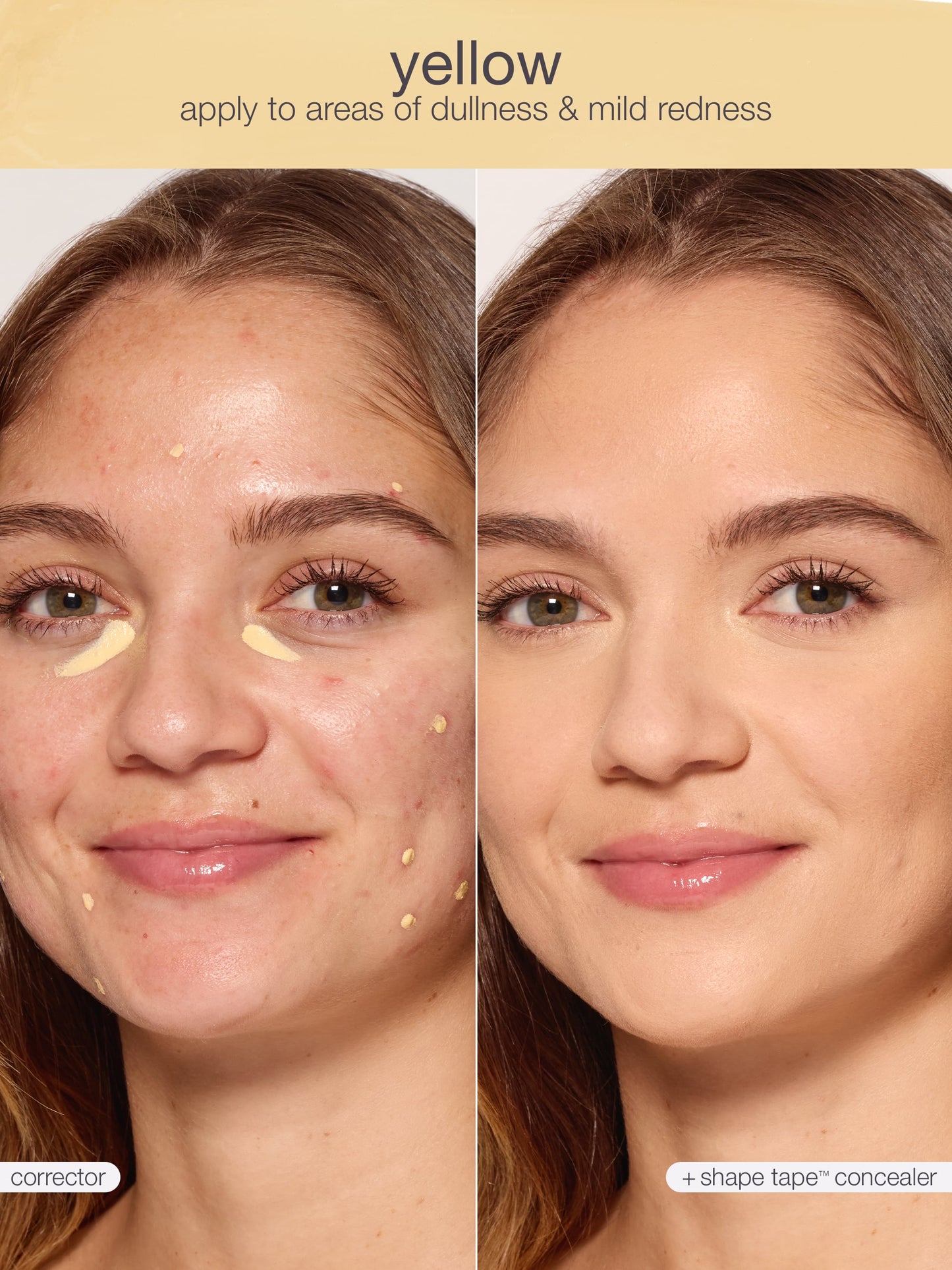 shape tape™ corrector