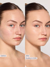 Before and after comparison of a woman's face with skin treatment labeled 'Nellie in 22N'.