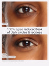 Before and after comparison of dark circles and redness reduction on a person's eye using Chandler in 49W.