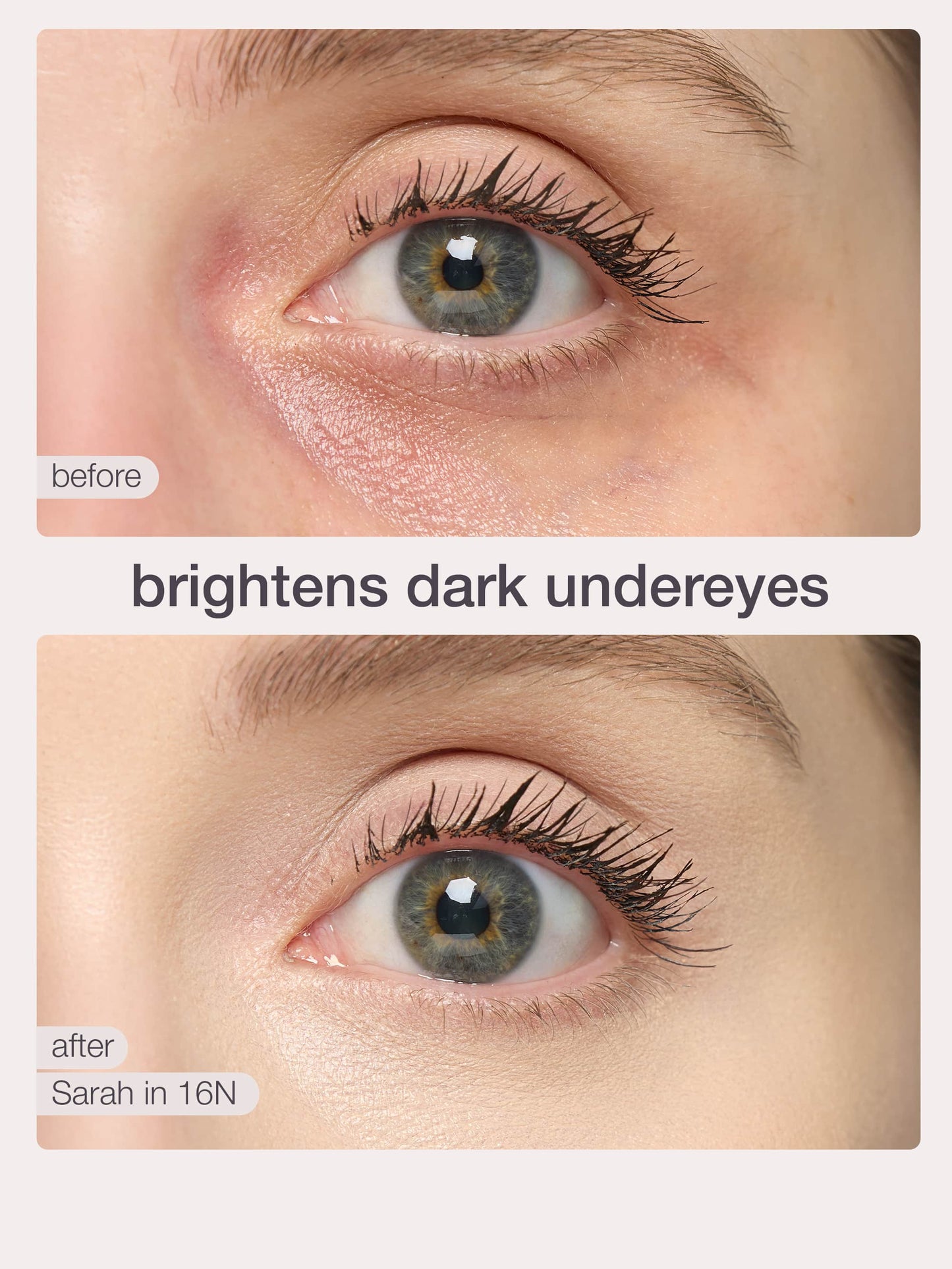 Before and after comparison of eye treatment showing brightened dark under eyes.