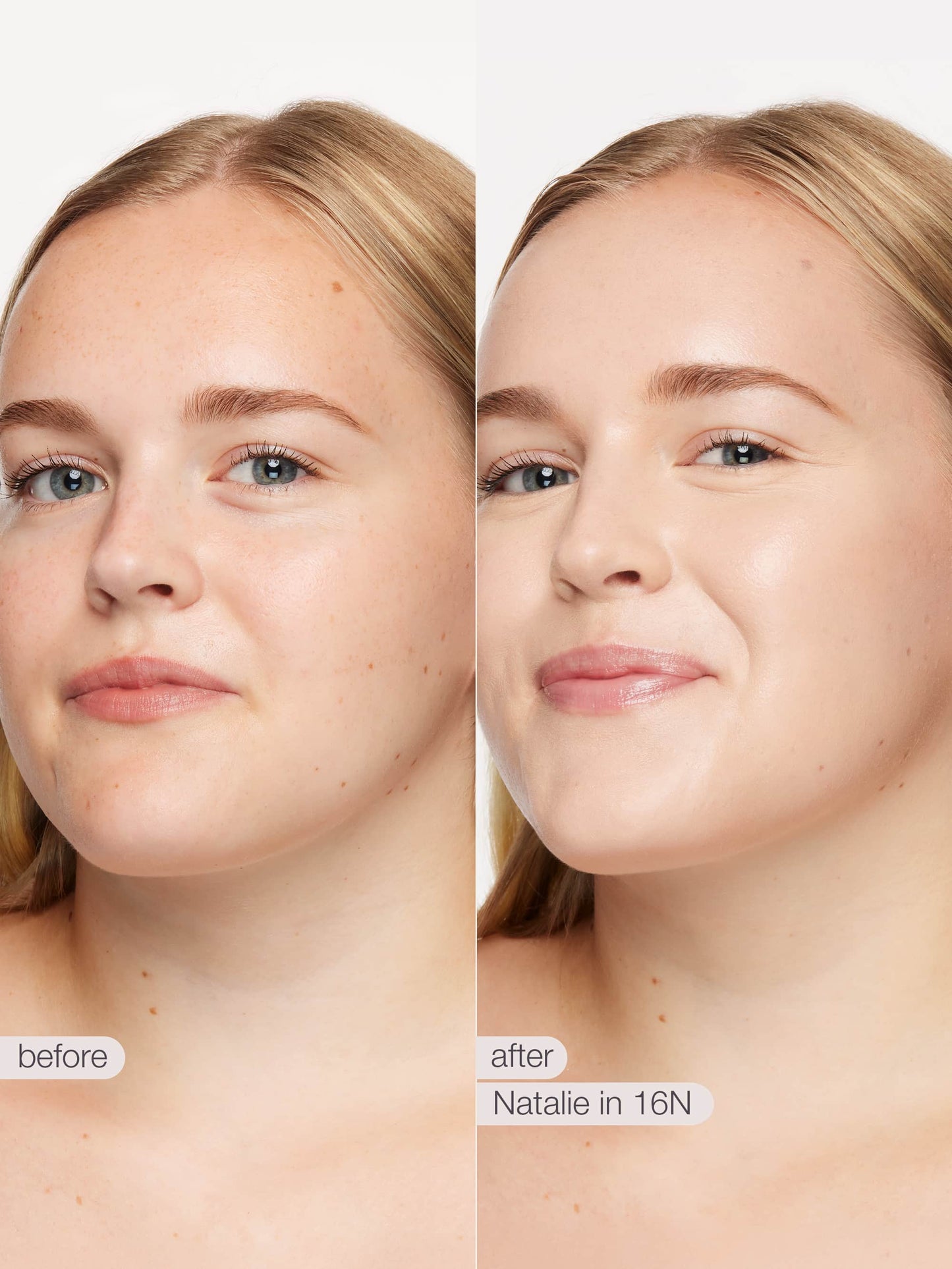 Before and after comparison of a woman's face with visible skin treatment results.