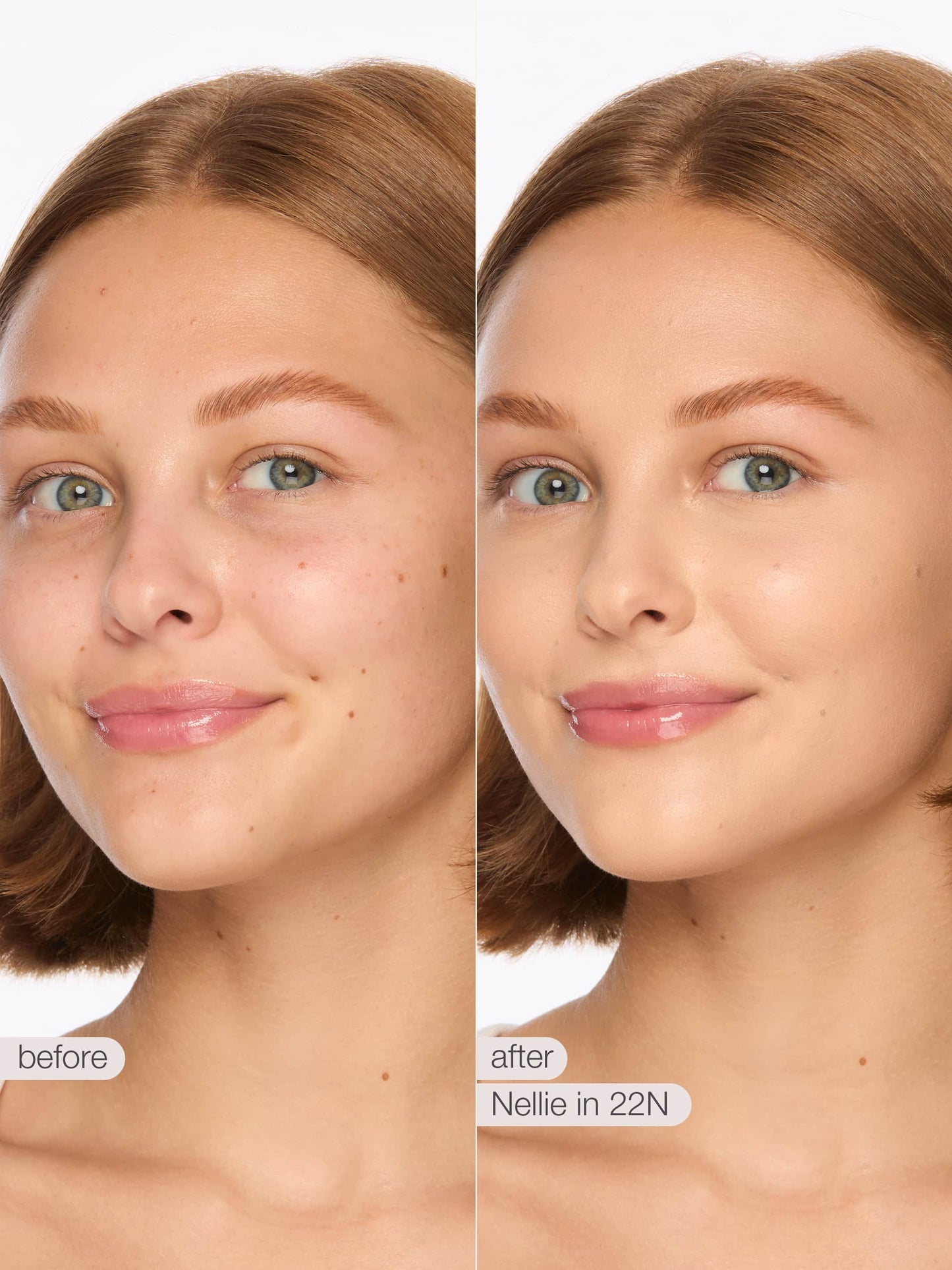 Before and after comparison of a woman's face with visible skin treatment results.